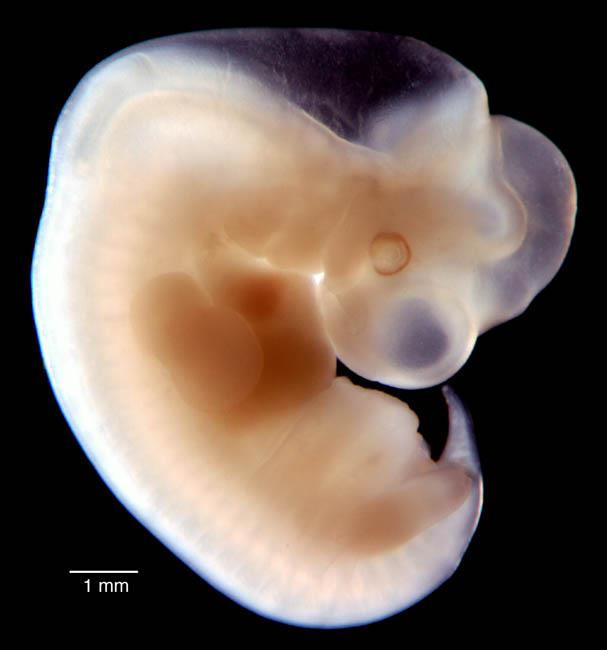 1mm